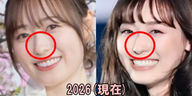 福原遥の2026年の鼻の画像