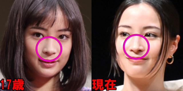 広瀬すずの2015年と2026年の鼻の画像