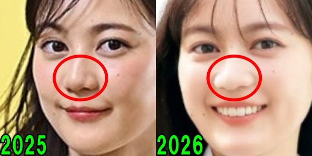生田絵梨花の2025年と2026年の鼻の画像