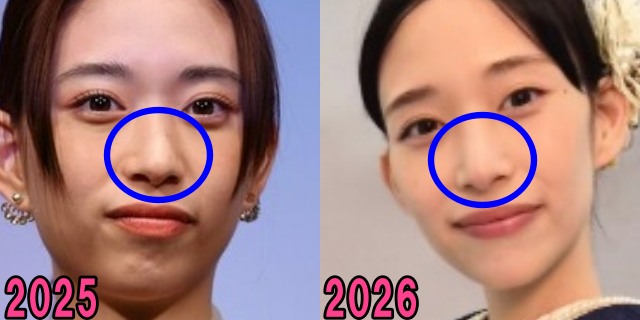 森川葵の2025年と2026年の鼻の画像