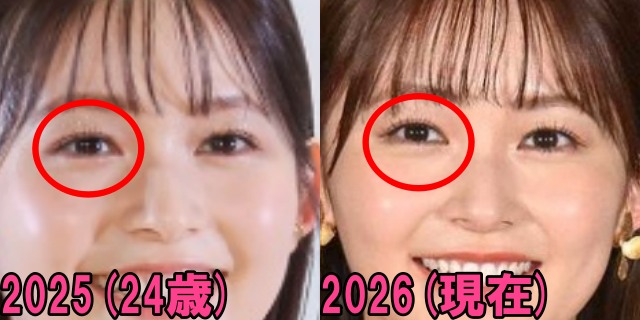 久間田琳加の2025年と2026年の目の画像
