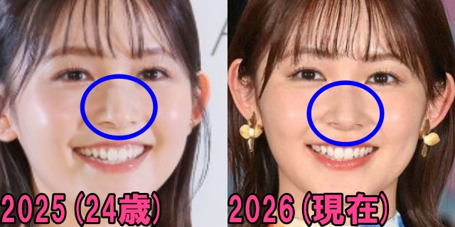 久間田琳加の2025年と2026年の鼻の画像