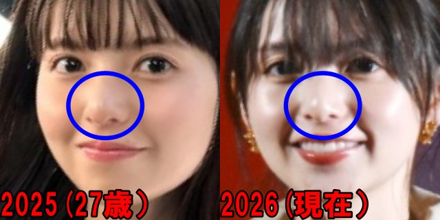齋藤飛鳥の2025年と2026年の鼻の画像